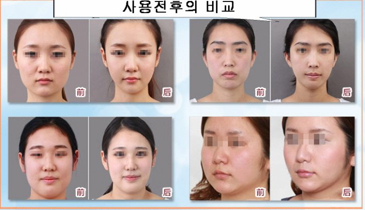 게르마늄로러 V라인 注文殺到 S라인 美의革命 3D입체게르마늄로러 게르마늄로러 V라인 注文殺到 S라인 美의革命 3D입체게르마늄로러
