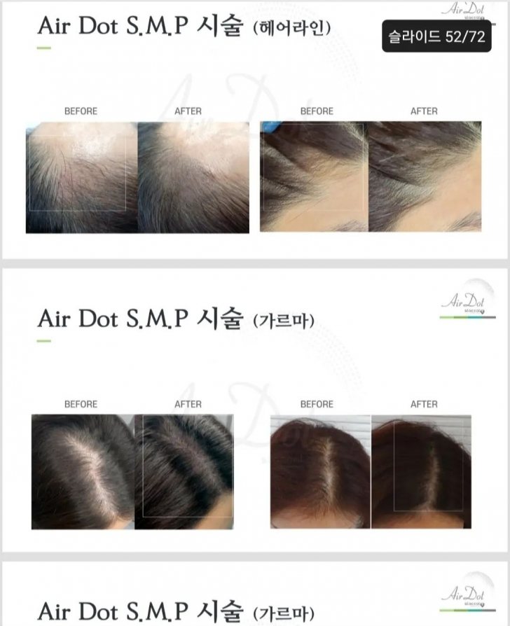 에어닷smp(싱글) 판매합니다 에어닷smp(싱글) 판매합니다